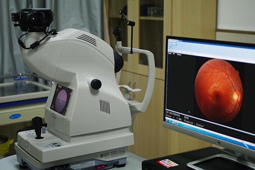 眼科光学相干断层扫描仪