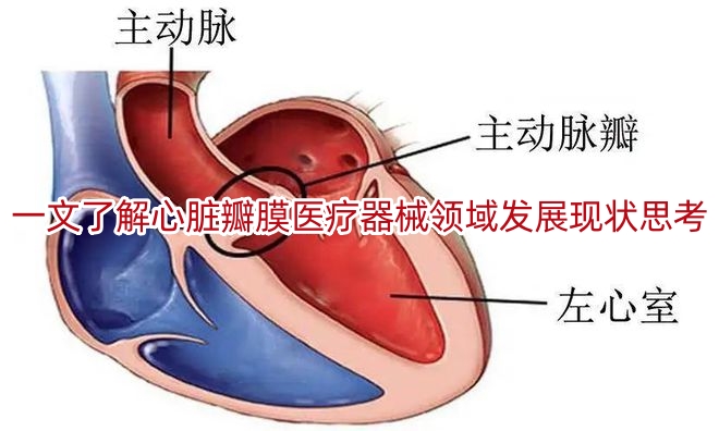 一文了解心脏瓣膜医疗器械领域发展现状思考