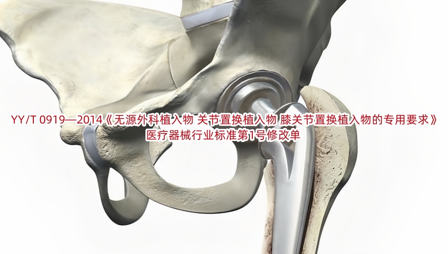 YY/T 0919—2014《无源外科植入物 关节置换植入物 膝关节置换植入物的专用要求》医疗器械行业标准第1号修改单