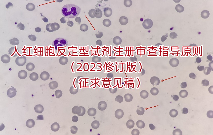 人红细胞反定型试剂注册审查指导原则（2023修订版）（征求意见稿）